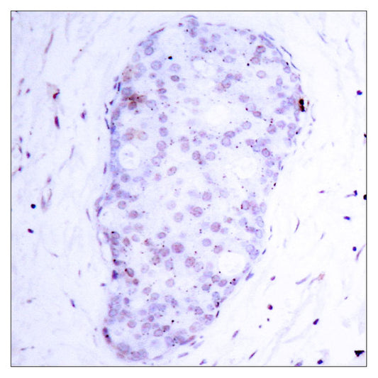 NFκB-p105 (phospho Ser907) Rabbit Polyclonal Antibody
