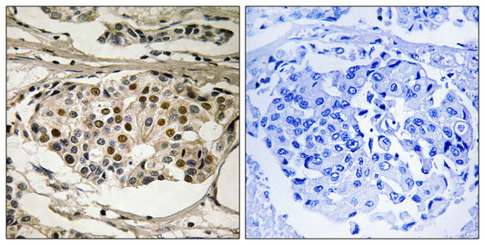 NFκB-p65 (phospho Ser281) Rabbit Polyclonal Antibody
