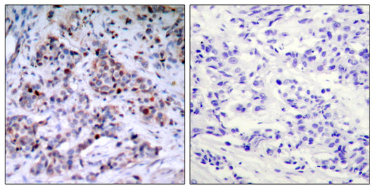 NFκB-p65 (phospho Thr435) Rabbit Polyclonal Antibody