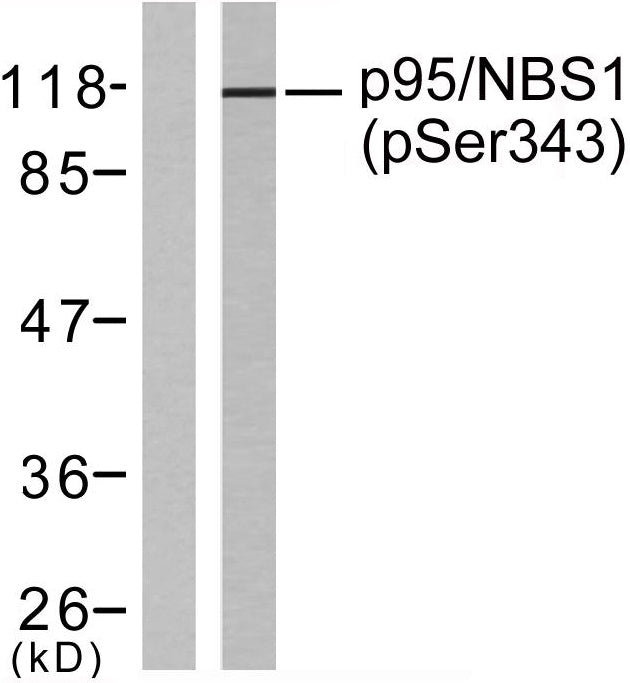 Nibrin (phospho Ser343) Rabbit Polyclonal Antibody