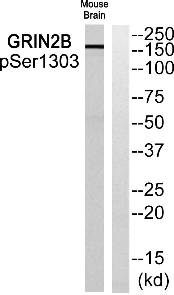 NMDAε2 (phospho Ser1303) Rabbit Polyclonal Antibody
