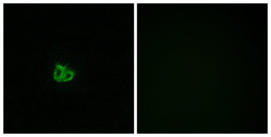 Op18 (phospho Ser16) Rabbit Polyclonal Antibody