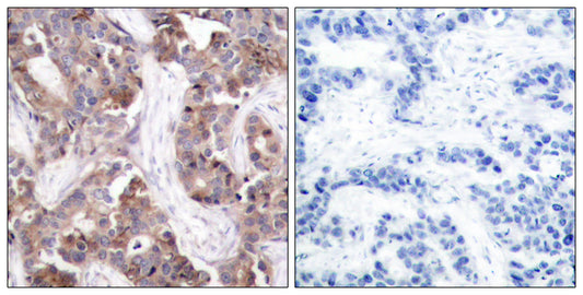 Op18 (phospho Ser25) Rabbit Polyclonal Antibody