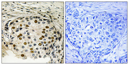 OSR1 (phospho Thr185) Rabbit Polyclonal Antibody