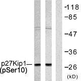 p27 (phospho Ser10) Rabbit Polyclonal Antibody