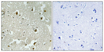 p27 (phospho Ser178) Rabbit Polyclonal Antibody