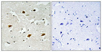 p27 (phospho Thr157) Rabbit Polyclonal Antibody