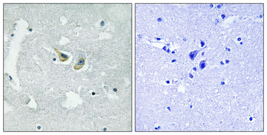 p47-phox (phospho Ser345) Rabbit Polyclonal Antibody
