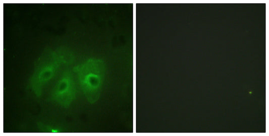 p47-phox (phospho Ser359) Rabbit Polyclonal Antibody