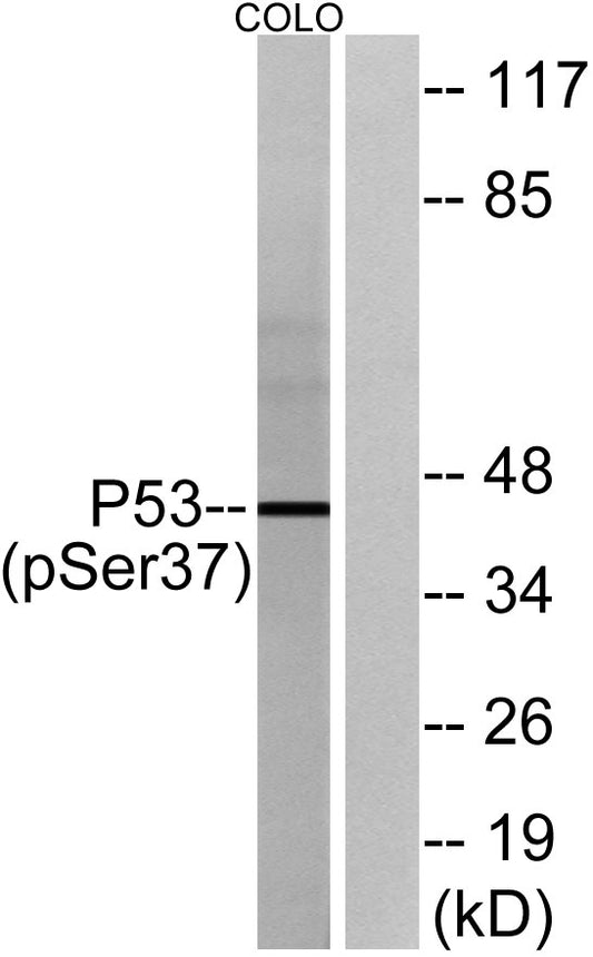 p53 (phospho Ser37) Rabbit Polyclonal Antibody