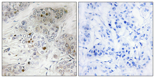 p53 (phospho Ser9) Rabbit Polyclonal Antibody