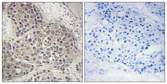 p70 S6 kinase α (phospho Ser447) Rabbit Polyclonal Antibody
