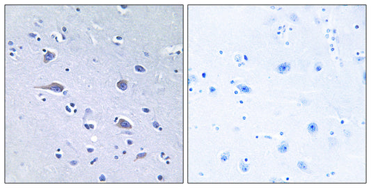 p70 S6 kinase α (phospho Thr229) Rabbit Polyclonal Antibody