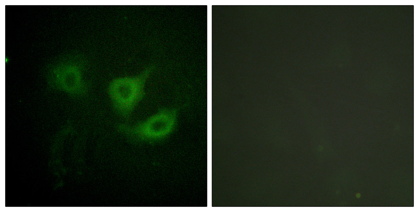 p70 S6 kinase α (phospho Thr412) Rabbit Polyclonal Antibody