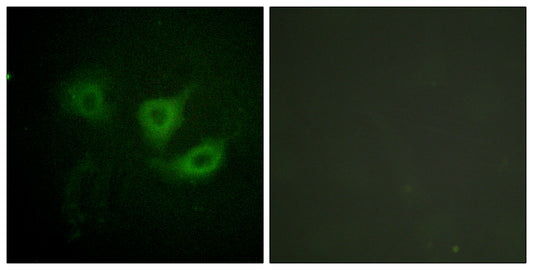 p70 S6 kinase α (phospho Thr412) Rabbit Polyclonal Antibody