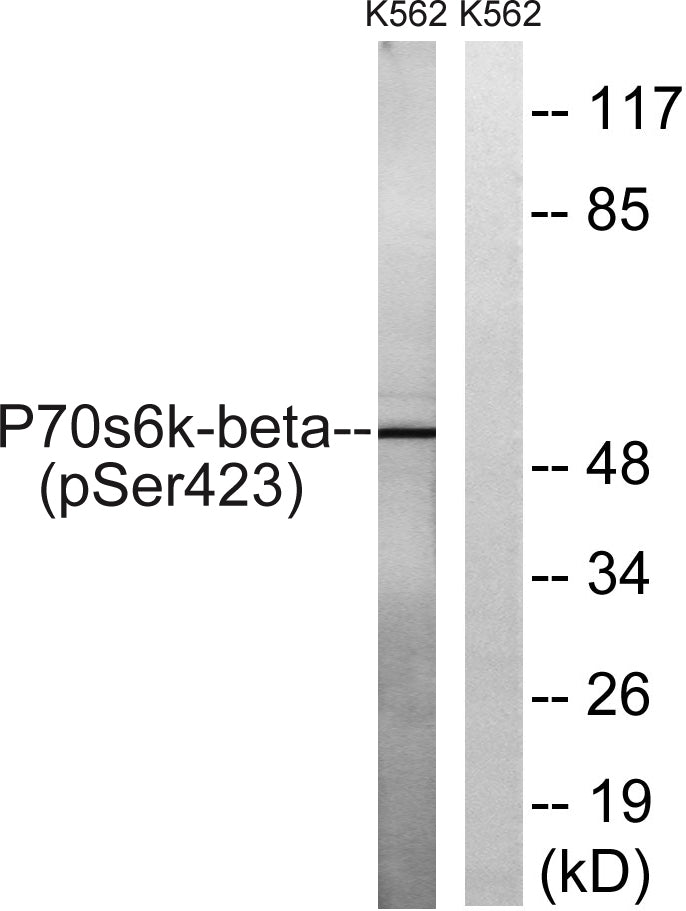 p70 S6 kinase β (phospho Ser423) Rabbit Polyclonal Antibody