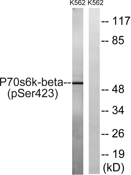 p70 S6 kinase β (phospho Ser423) Rabbit Polyclonal Antibody