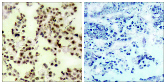 p73 (phospho Tyr99) Rabbit Polyclonal Antibody