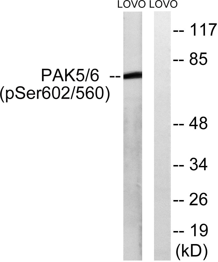 PAK5/6 (phospho Ser602/S560) Rabbit Polyclonal Antibody