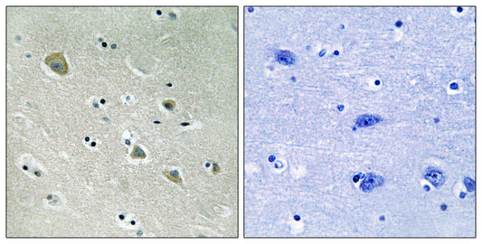 PAKα (phospho Ser204) Rabbit Polyclonal Antibody