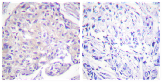 PAKα (phospho Thr212) Rabbit Polyclonal Antibody