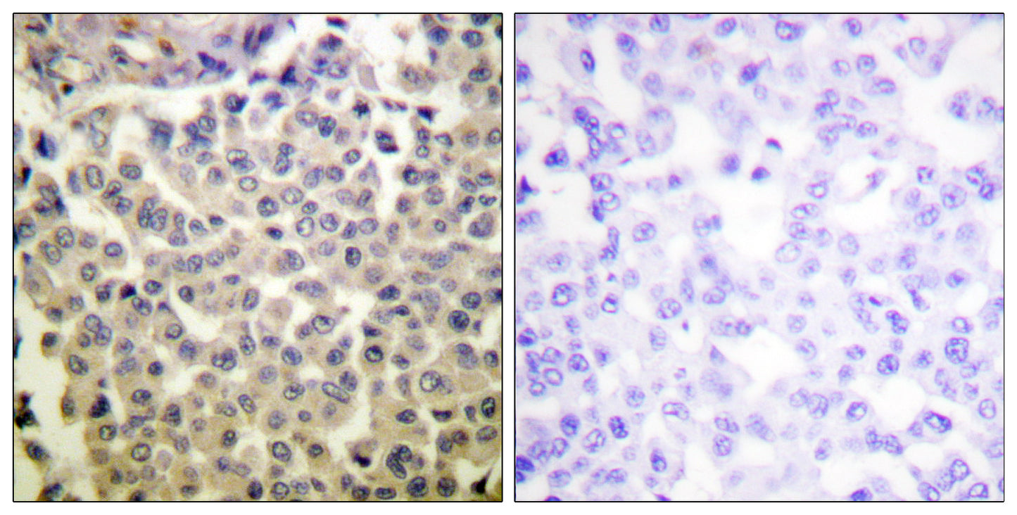 PAKα/β/γ (phospho Thr423/402/421) Rabbit Polyclonal Antibody