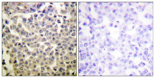 PAKα/β/γ (phospho Thr423/402/421) Rabbit Polyclonal Antibody