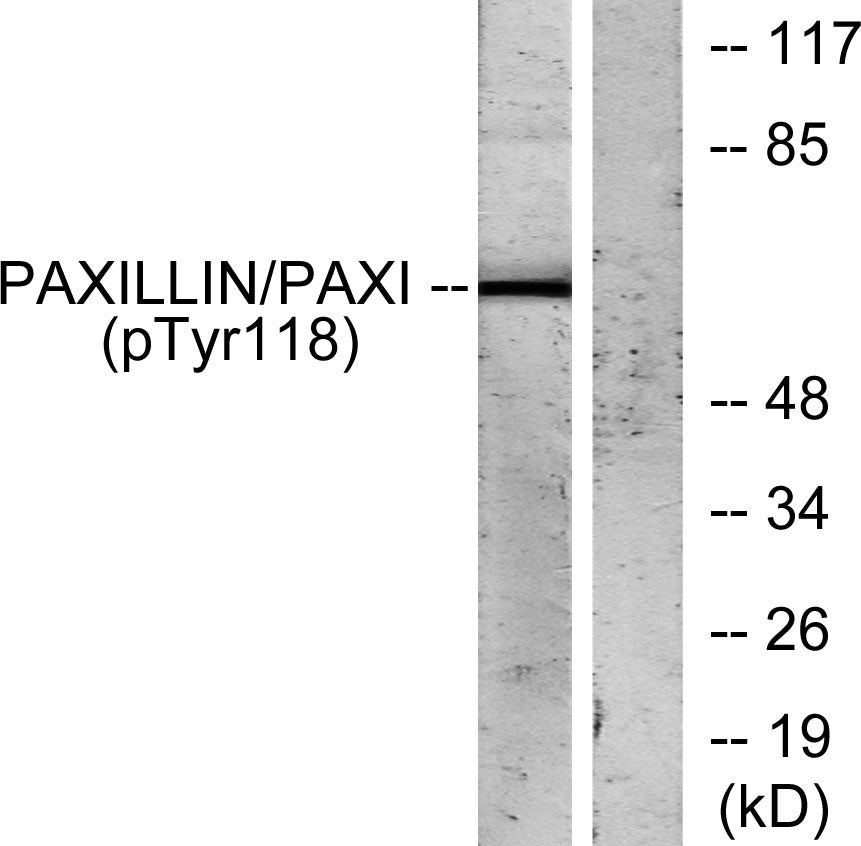 Paxillin (phospho Tyr118) Rabbit Polyclonal Antibody