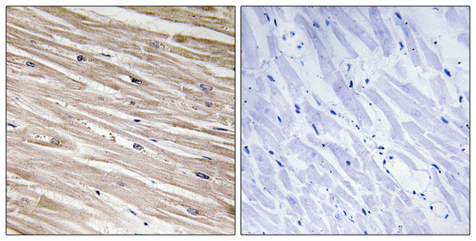 PEA-15 (phospho Ser104) Rabbit Polyclonal Antibody