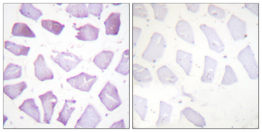 PEA-15 (phospho Ser116) Rabbit Polyclonal Antibody