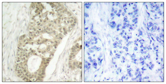 PKC δ (phospho Ser645) Rabbit Polyclonal Antibody