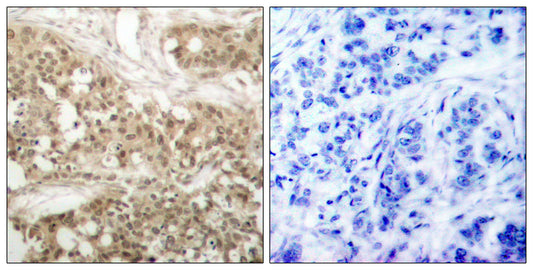 PKC θ (phospho Ser676) Rabbit Polyclonal Antibody