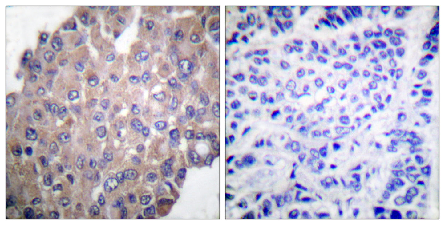 PLC γ1 (phospho Tyr771) Rabbit Polyclonal Antibody