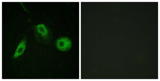 PLC γ2 (phospho Tyr1217) Rabbit Polyclonal Antibody