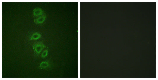 PP2A-Cα (phospho Tyr307) Rabbit Polyclonal Antibody