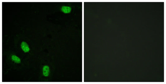 PR (phospho Ser294) Rabbit Polyclonal Antibody