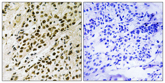 PRAK (phospho Thr182) Rabbit Polyclonal Antibody