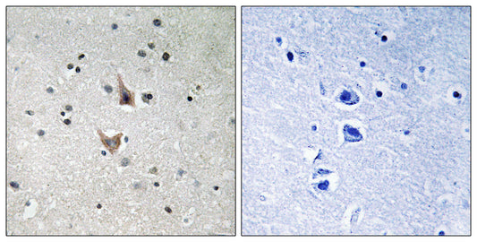 Presenilin 1 (phospho Ser357) Rabbit Polyclonal Antibody