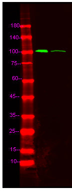 PRK1 (phospho-Thr774)/PRK2 (phospho-Thr816) Rabbit Polyclonal Antibody