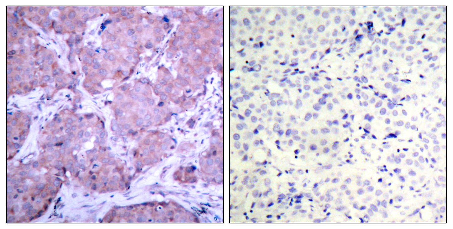 PTEN (phospho Ser380) Rabbit Polyclonal Antibody