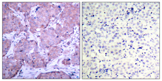 PTEN (phospho Ser380) Rabbit Polyclonal Antibody
