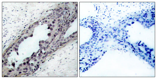 PTEN (phospho Ser380/T382/T383) Rabbit Polyclonal Antibody
