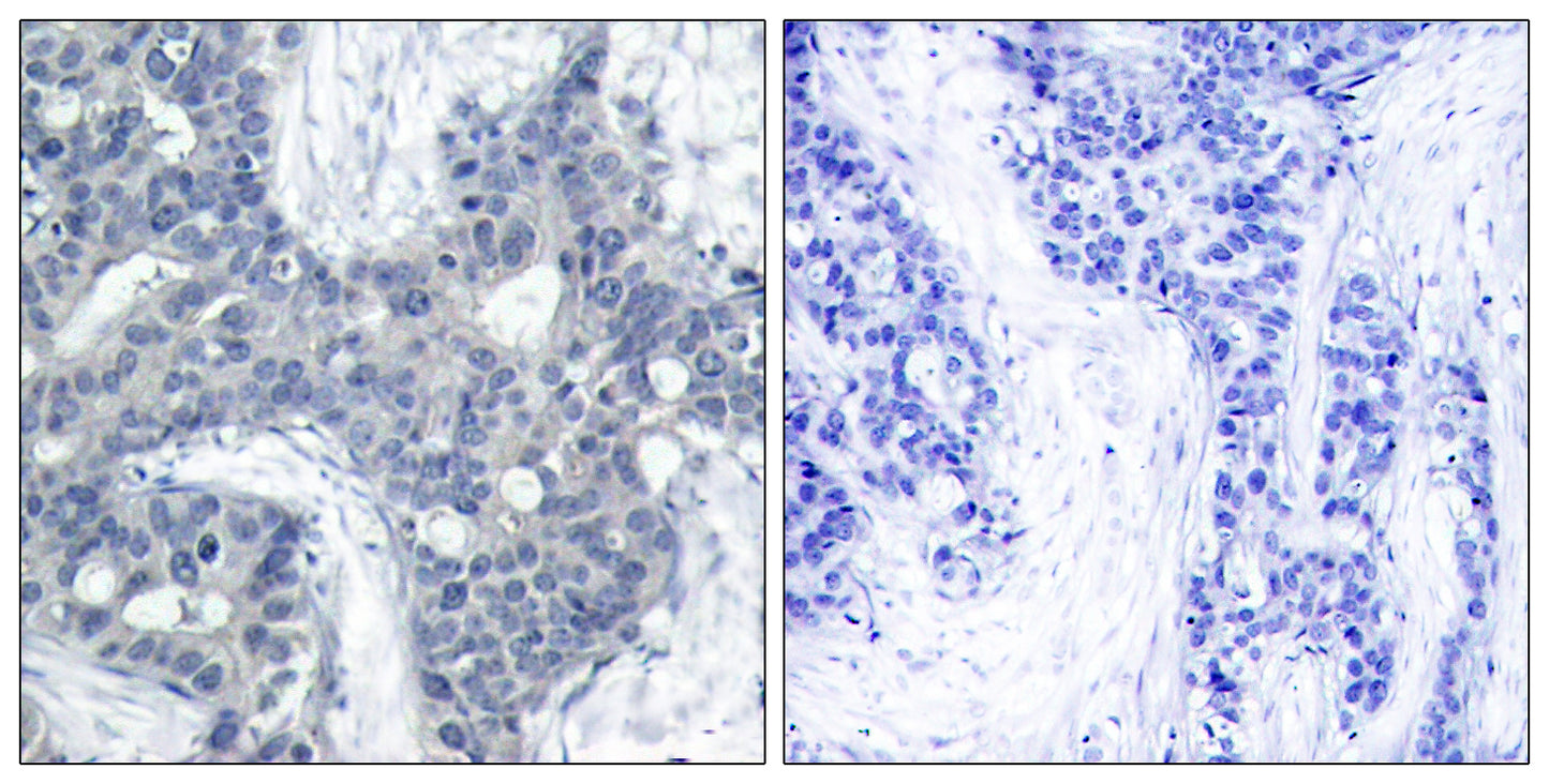 PYK2 (phospho Tyr402) Rabbit Polyclonal Antibody