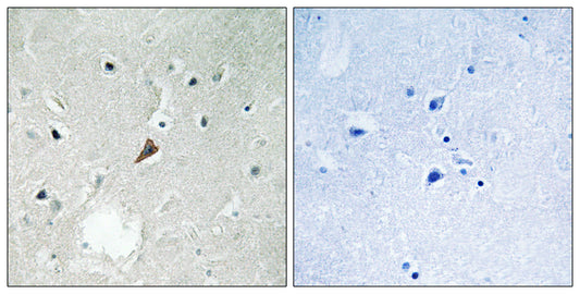PYK2 (phospho Tyr579) Rabbit Polyclonal Antibody