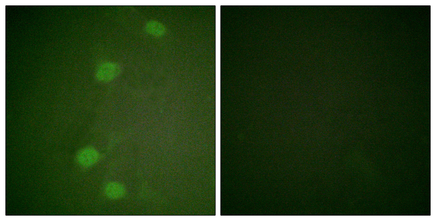 Rb (phospho Ser249) Rabbit Polyclonal Antibody