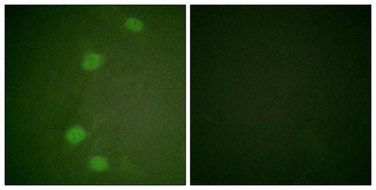 Rb (phospho Ser249) Rabbit Polyclonal Antibody
