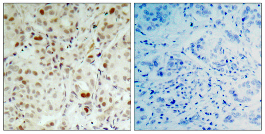 Rb (phospho Ser807) Rabbit Polyclonal Antibody