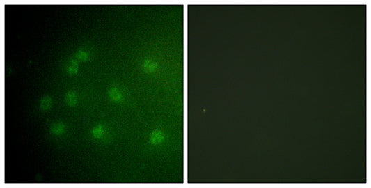 Rb (phospho Thr826) Rabbit Polyclonal Antibody