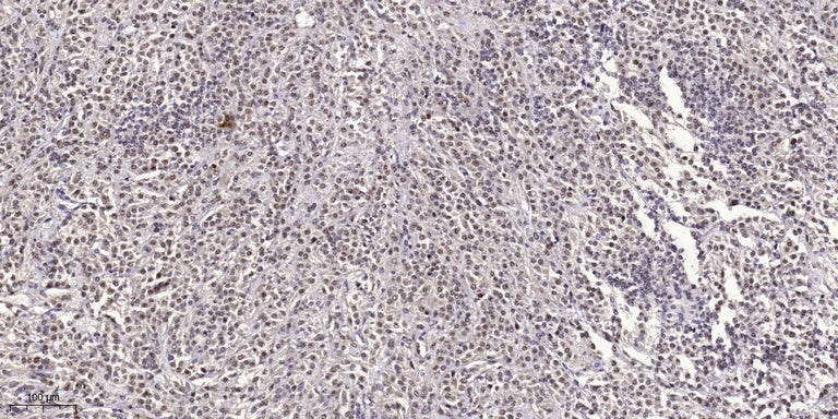 SCG10 (phospho Ser73) Rabbit Polyclonal Antibody