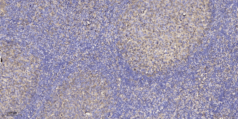 Shc (phospho Ser36) Rabbit Polyclonal Antibody